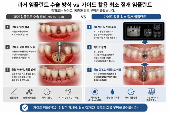 하양치과, 임플란트가 무서워서 미룬다면 네비게이션 임플란트를 확인하세요. 7 image 135