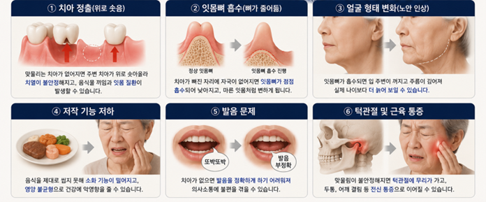 하양읍치과 틀니가 자꾸 불편한 이유, 임플란트와 차이는? 7 image 95